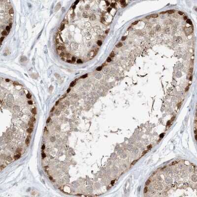 Immunohistochemistry-Paraffin: RNF219 Antibody [NBP2-33979]