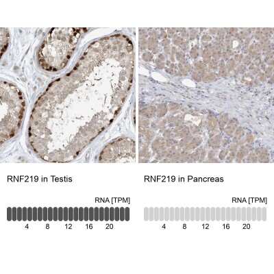 Immunohistochemistry-Paraffin: RNF219 Antibody [NBP2-33979]