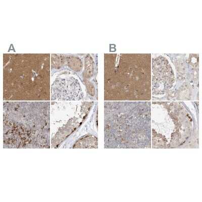 Immunohistochemistry-Paraffin: RNF219 Antibody [NBP2-33979]