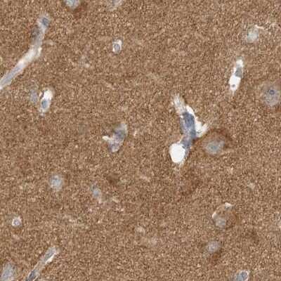 Immunohistochemistry-Paraffin: RNF219 Antibody [NBP2-33979]