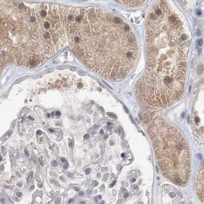 Immunohistochemistry-Paraffin: RNF219 Antibody [NBP2-33979]