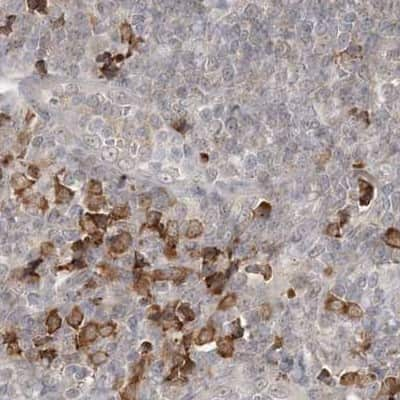 Immunohistochemistry-Paraffin: RNF219 Antibody [NBP2-33979]