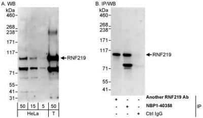 Western Blot: RNF219 Antibody [NBP1-40358]