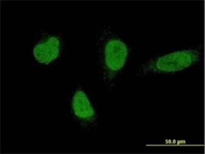 Immunocytochemistry/ Immunofluorescence: RNF220 Antibody (5E5) [H00055182-M01]