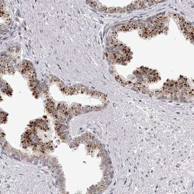 Immunohistochemistry-Paraffin: RNF220 Antibody [NBP1-88487]