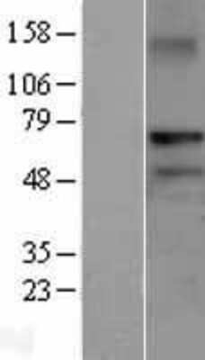 Western Blot: RNF220 Overexpression Lysate [NBL1-15446]