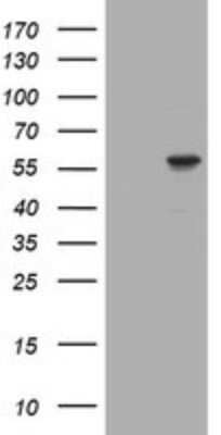 Western Blot: RNF23 Antibody (OTI2A6) [NBP2-46014]