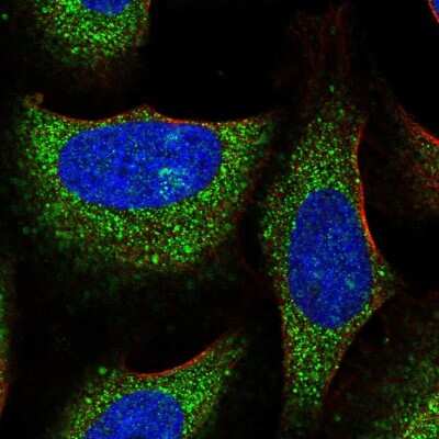 Immunocytochemistry/ Immunofluorescence: RNF23 Antibody [NBP2-56934]