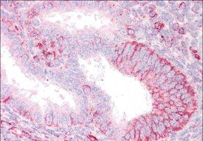 Immunohistochemistry-Paraffin: RNF23 Antibody [NB100-1187]