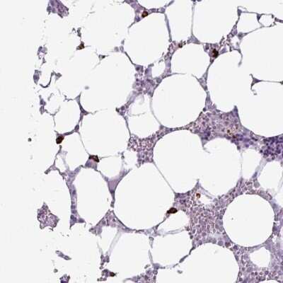 Immunohistochemistry-Paraffin: RNF23 Antibody [NBP2-33605]