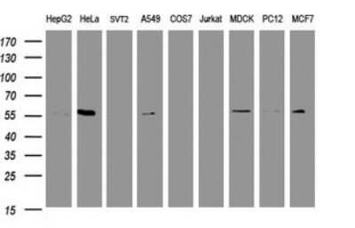 Western Blot: RNF23 Antibody (OTI2A6)Azide and BSA Free [NBP2-73926]