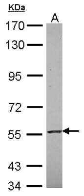 Western Blot: RNF23 Antibody [NBP2-20183]