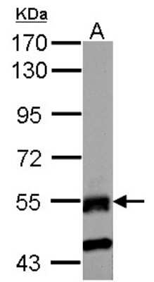 Western Blot: RNF23 Antibody [NBP2-20183]