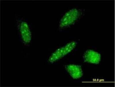 Immunocytochemistry/ Immunofluorescence: RNF24 Antibody (4C6) [H00011237-M01]