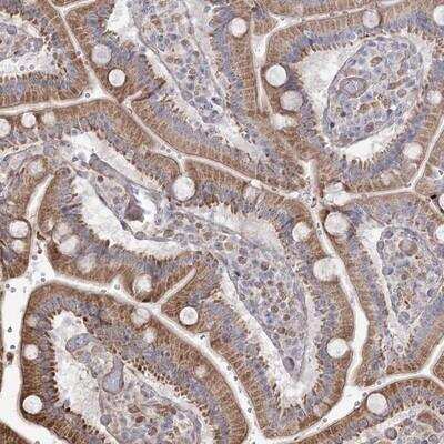 Immunohistochemistry-Paraffin: RNF24 Antibody [NBP1-81859]