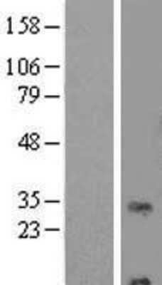 Western Blot: RNF24 Overexpression Lysate [NBP2-09534]