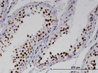 Immunohistochemistry-Paraffin: RNF25 Antibody (1D10) [H00064320-M07]
