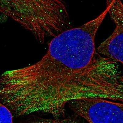 Immunocytochemistry/ Immunofluorescence: RNF25 Antibody [NBP1-89069]