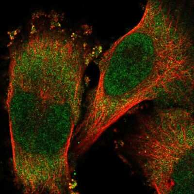 Immunocytochemistry/ Immunofluorescence: RNF25 Antibody [NBP2-32664]