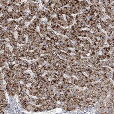 Immunohistochemistry: RNF25 Antibody [NBP2-32664]