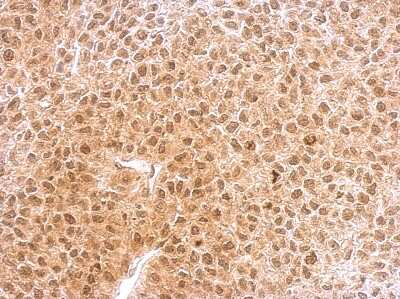 Immunohistochemistry-Paraffin: RNF25 Antibody [NBP1-31491]