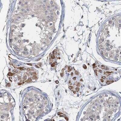 Immunohistochemistry-Paraffin: RNF25 Antibody [NBP1-89069]