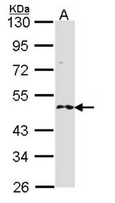 Western Blot: RNF25 Antibody [NBP1-31491]