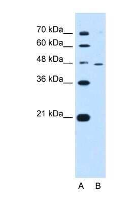 Western Blot: RNF25 Antibody [NBP1-55063]