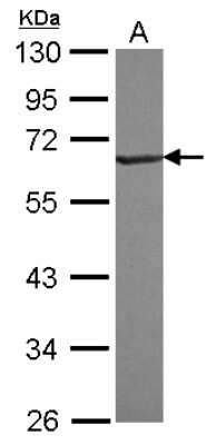 Western Blot: RNF25 Antibody [NBP2-20184]