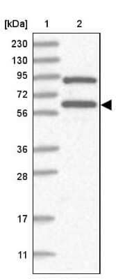 Western Blot: RNF25 Antibody [NBP2-32664]