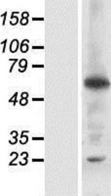 Western Blot: RNF25 Overexpression Lysate [NBP2-06433]