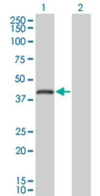 Western Blot: RNF26 Antibody (5B9) [H00079102-M01]