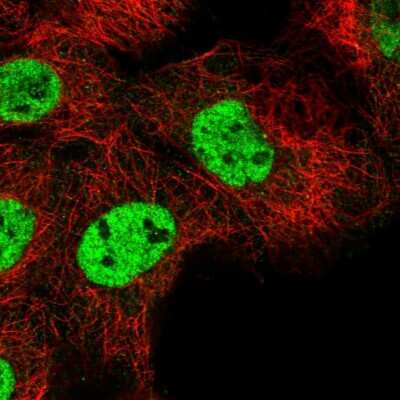 Immunocytochemistry/ Immunofluorescence: RNF26 Antibody [NBP1-81150]