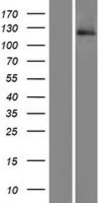 Western Blot: HOIP/RNF31 Overexpression Lysate [NBL1-15450]