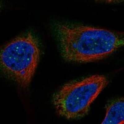 Immunocytochemistry/ Immunofluorescence: RNF32 Antibody [NBP3-17430]