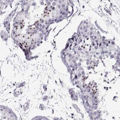 Immunohistochemistry-Paraffin: RNF32 Antibody [NBP2-57968]