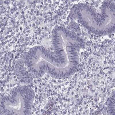Immunohistochemistry-Paraffin: RNF32 Antibody [NBP2-57968]