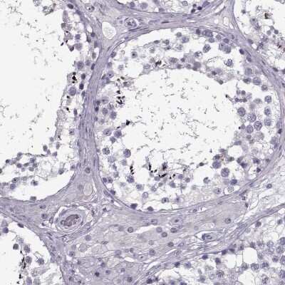 Immunohistochemistry-Paraffin: RNF32 Antibody [NBP2-57968]