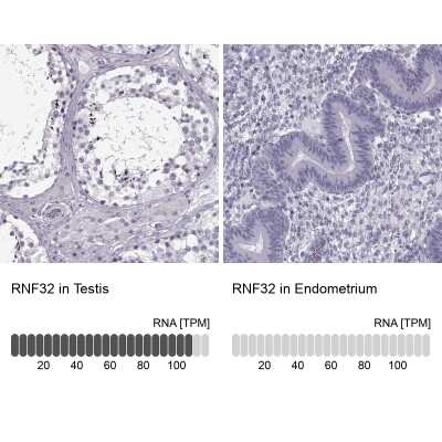 Immunohistochemistry-Paraffin: RNF32 Antibody [NBP2-57968]