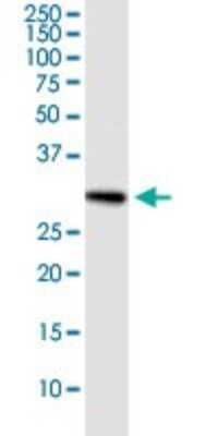 Immunoprecipitation: RNF32 Antibody [H00140545-D01P]