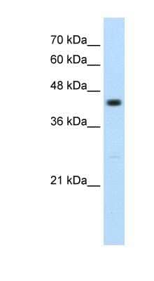 Western Blot: RNF32 Antibody [NBP1-55067]