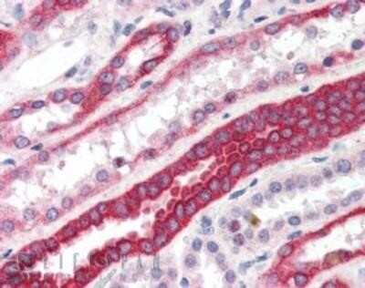 Immunohistochemistry-Paraffin: RNF34 Antibody [NB100-1202]