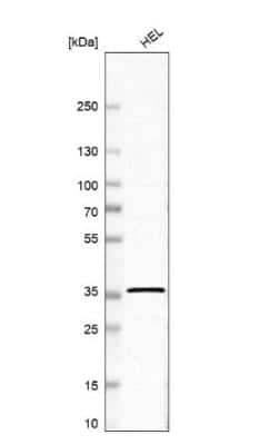 Western Blot: RNF34 Antibody [NBP2-56413]