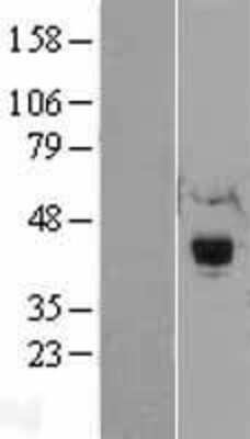 Western Blot: RNF34 Overexpression Lysate [NBL1-15451]