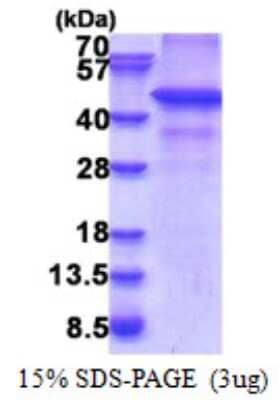 SDS-PAGE: Recombinant Human RNF34 His Protein [NBP2-23440]