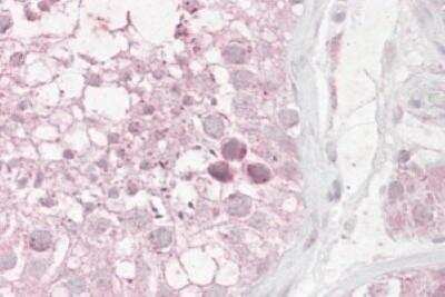 Immunohistochemistry-Paraffin: RNF36 Antibody [NB100-1207]