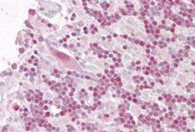 Immunohistochemistry-Paraffin: RNF36 Antibody [NB100-1207]