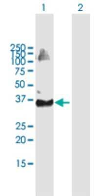 Western Blot: RNF36 Antibody [H00140691-B01P]