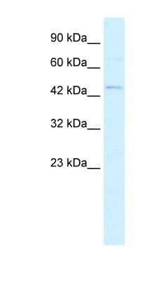 Western Blot: RNF36 Antibody [NBP1-80052]