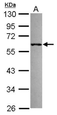 Western Blot: RNF36 Antibody [NBP2-20186]